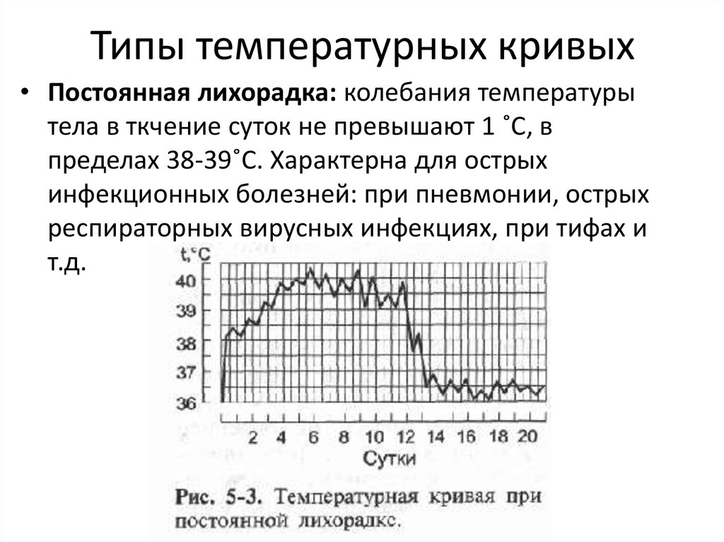 Изменение температуры больного. Тип лихорадки и температурная кривая. Типы температурных кривых при лихорадке. Тип температурной Кривой при пневмонии. Типы температурных кривых схема.