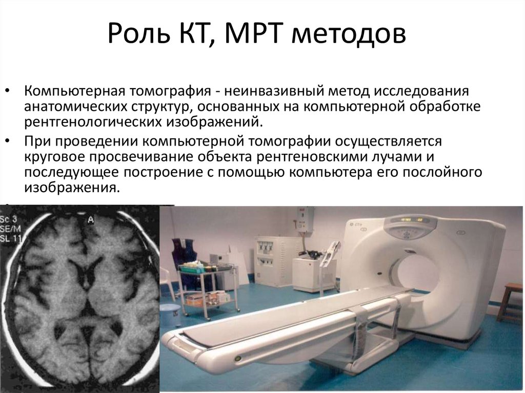 Пройти кате. Рентгеновская томография метод исследования. Магнитно-резонансная томография метод исследования. Магниторезонансная томография методы. Компьютерная томография относится к методам исследования.