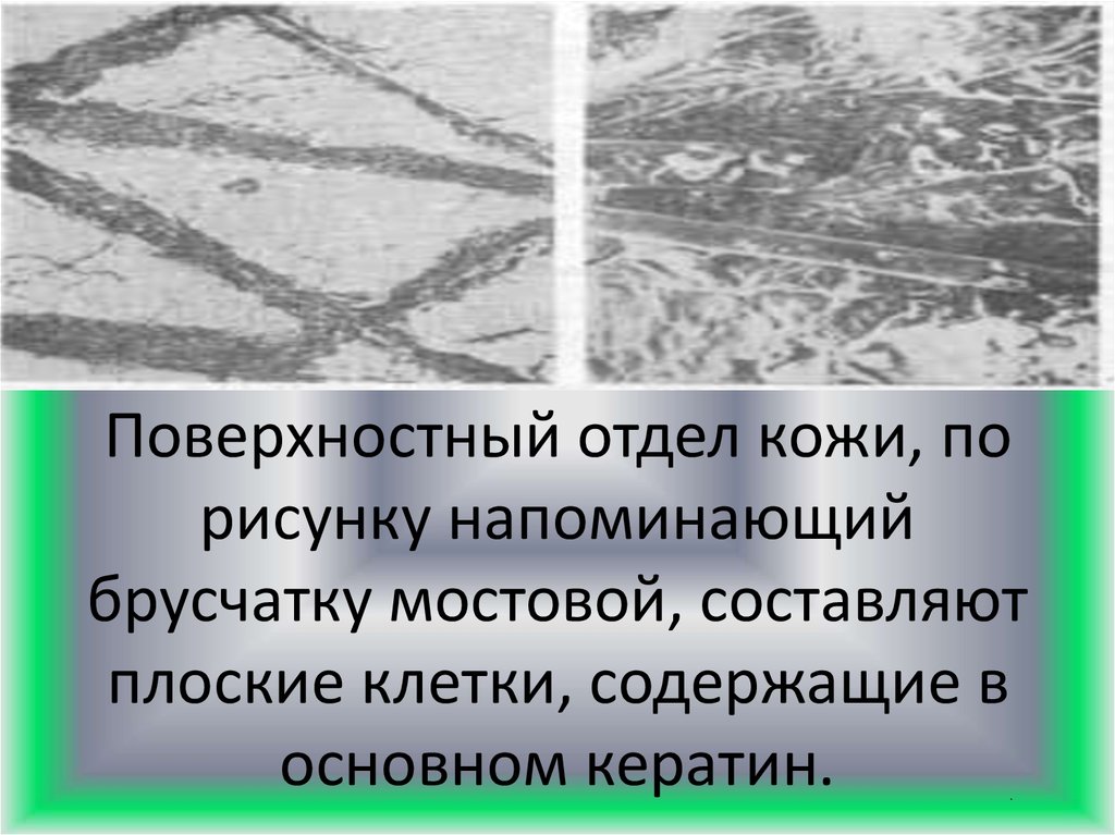Поверхностный отдел кожи, по рисунку напоминающий брусчатку мостовой, составляют плоские клетки, содержащие в основном кератин.