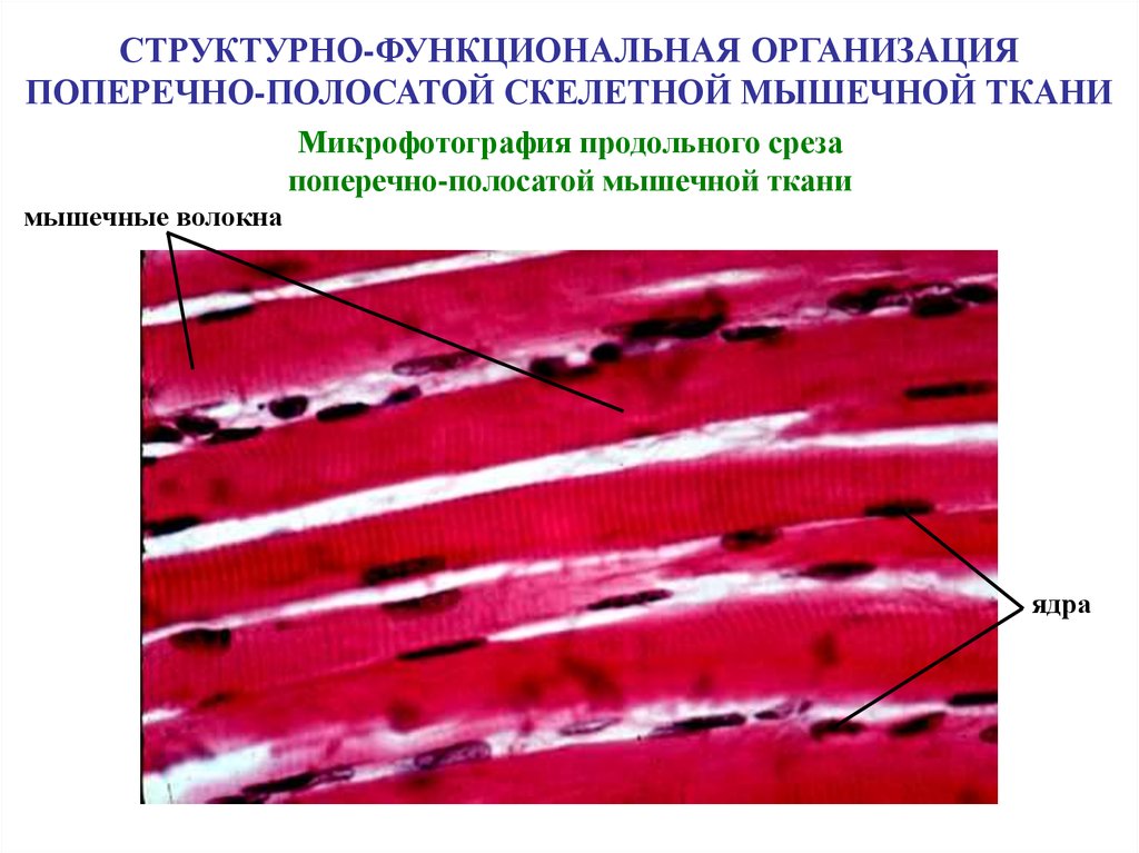 Поперечнополосатые мышцы. Скелетная мышечная ткань микрофотография. Поперечно исчерченная Скелетная мышечная ткань. Волокна поперечно-полосатой мышечной ткани. Поперечно-полосатая Скелетная мышечная ткань продольный срез.