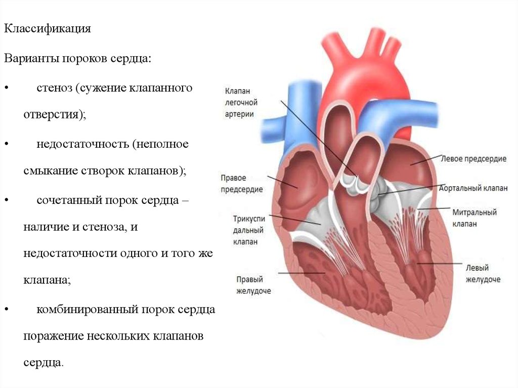 Легочная артерия сердца рисунок