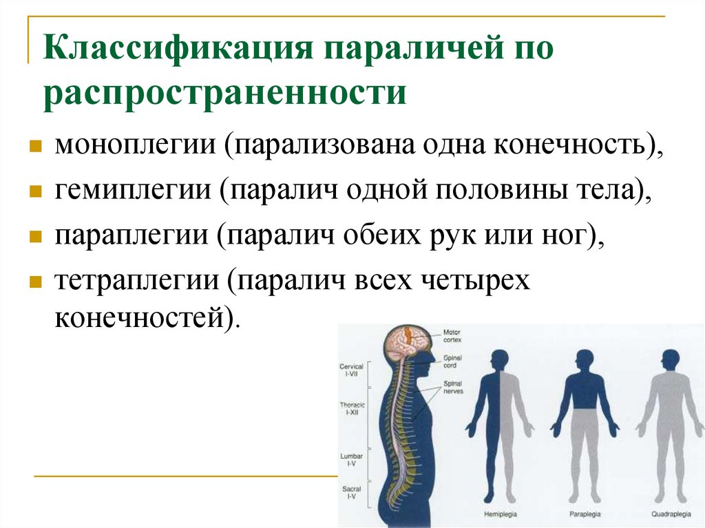 Парализованы руки и ноги. Классификация параличей. Классификация парезов и параличей. Паралич нервной системы.