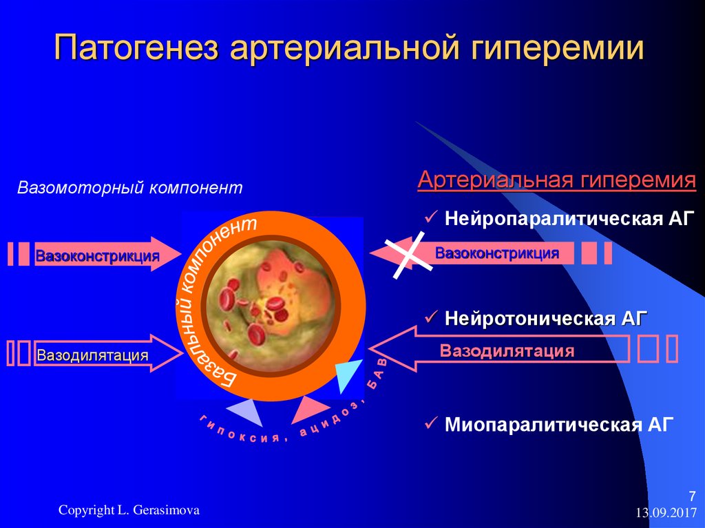 Артериальная гиперемия механизмы развития. Патогенез артериального полнокровия. Патогенез патологической артериальной гиперемии. Механизмы развития артериальной гиперемии патофизиология. Этиология артериальной гиперемии.