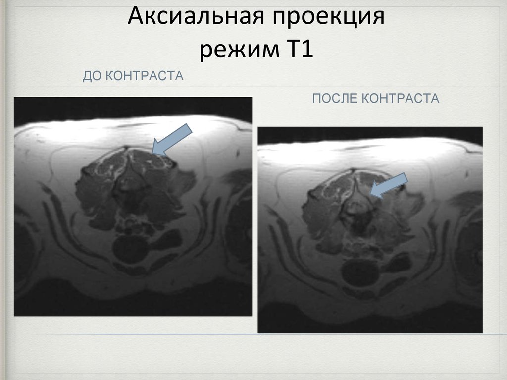 После контраста. Аксиальная проекция. Анатомия на кт в аксиальной проекции. Аксиальная проекция рентген. Аксиальная плоскость рентген.