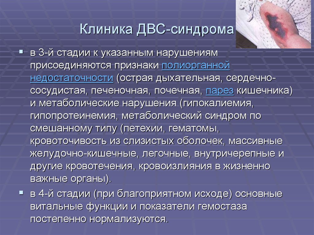 Перенести синдром. Синдром полиорганной недостаточности патогенез. ДВС синдром клиника. Клинические проявления ДВС синдрома.