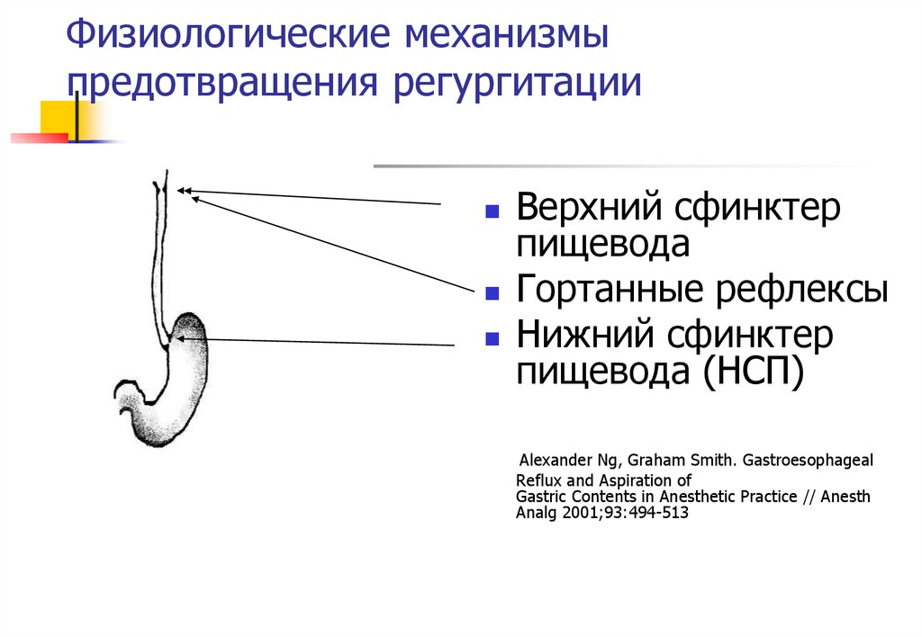 Верхний сфинктер пищевода