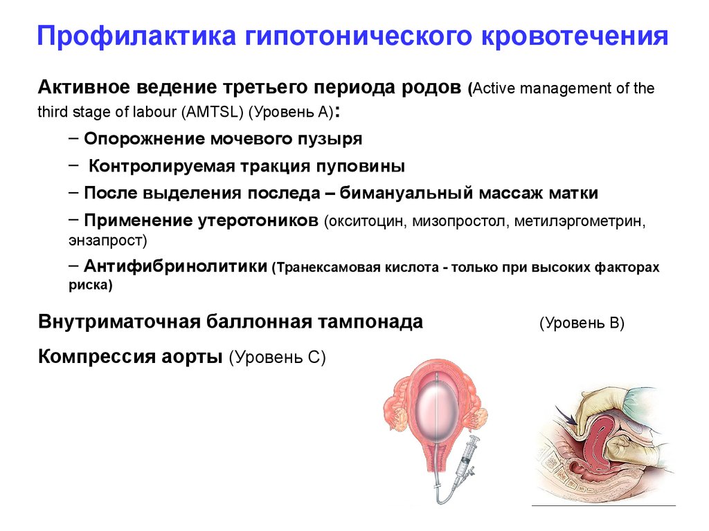 Родовые кровотечения. Профилактика гипотонического маточного кровотечения. Послеродовые гипотонические кровотечения. Профилактика маточных кровотечений после родов. Послеродовой гипотоническое кровотечение 3 периода рода.