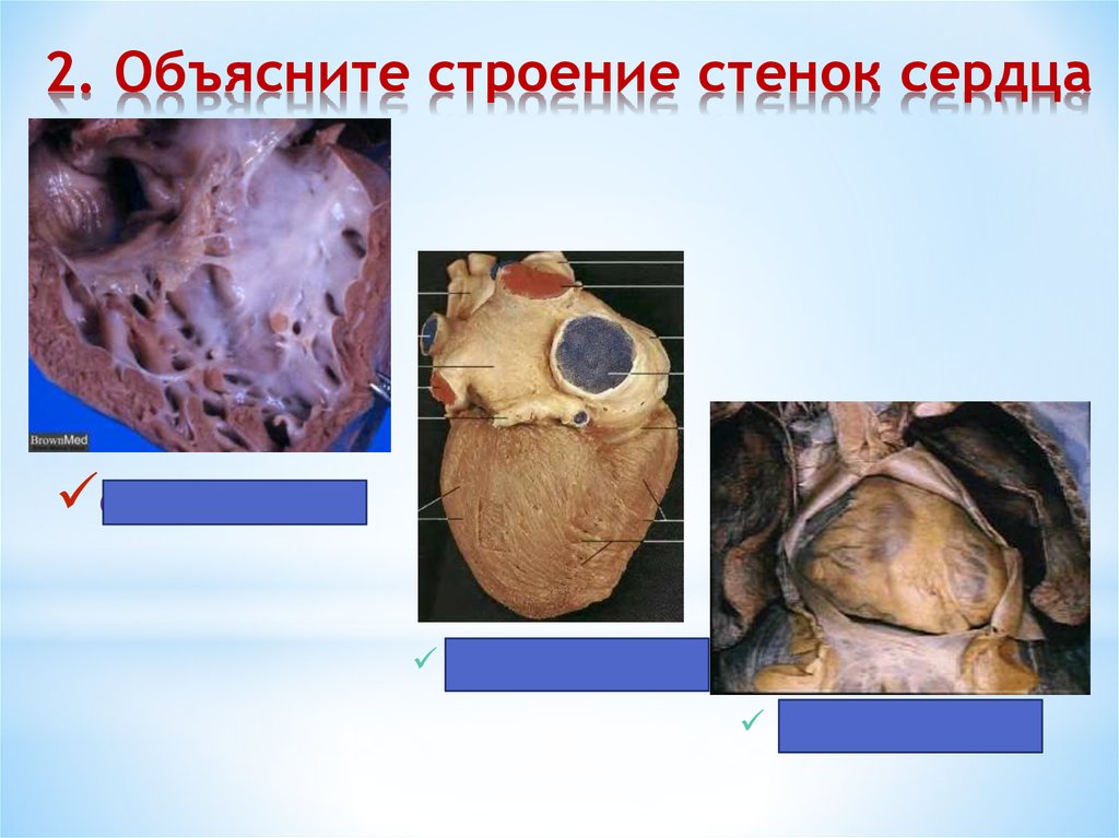 2. Объясните строение стенок сердца