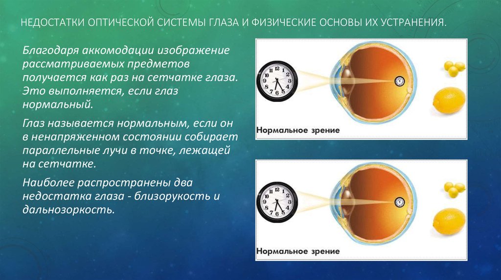 Презентация глаз как оптическая система 7 класс