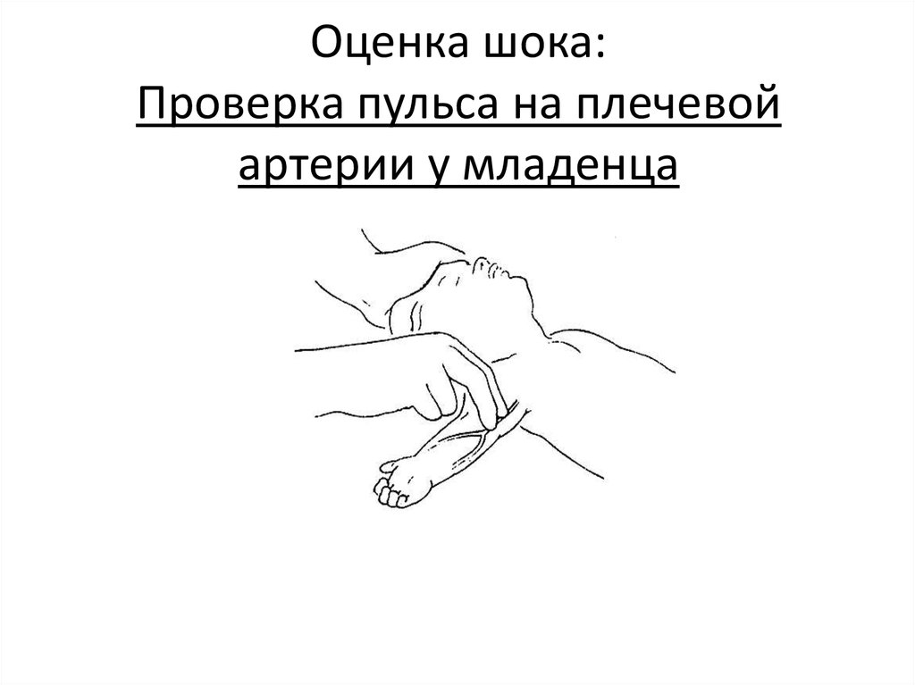 Убери руки с моего пульса оригинал. Измерение пульса на плечевой артерии. Пульс на плечевой артерии. Техника измерения пульса у детей. Пальпация пульса на плечевой артерии у детей.