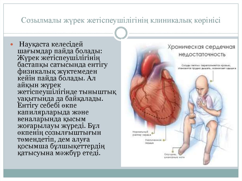 Созылмалы жүрек жетіспеушілігі презентация