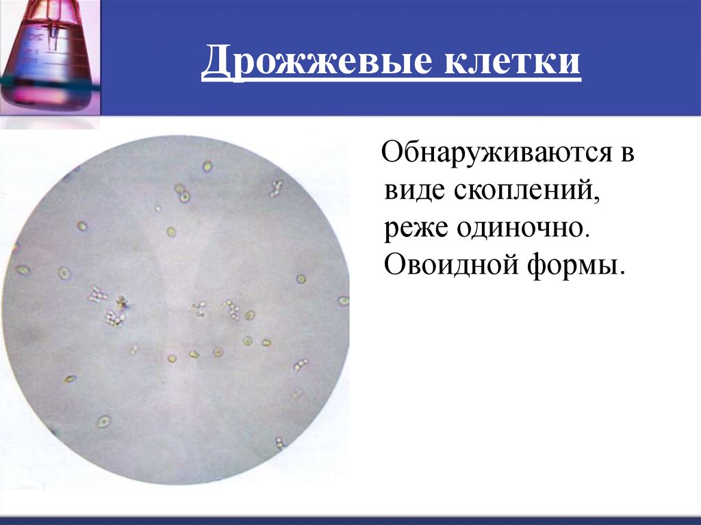 Организованный и неорганизованный осадок мочи презентация