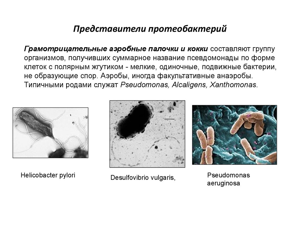 Представители группы бактерии. Грамотрицательные аэробные палочки. Аэробные грамотрицательные бактерии. Грамотрицательные подвижные палочки. Грамотрицательные кокки представители.