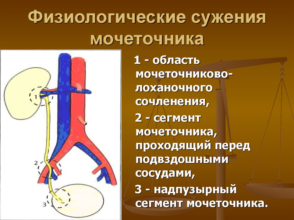 3 части мочеточника. Физиологические сужения мочеточника. Сужения мочеточника анатомия. Анатомические сужения мочеточника. Сегменты мочеточника.
