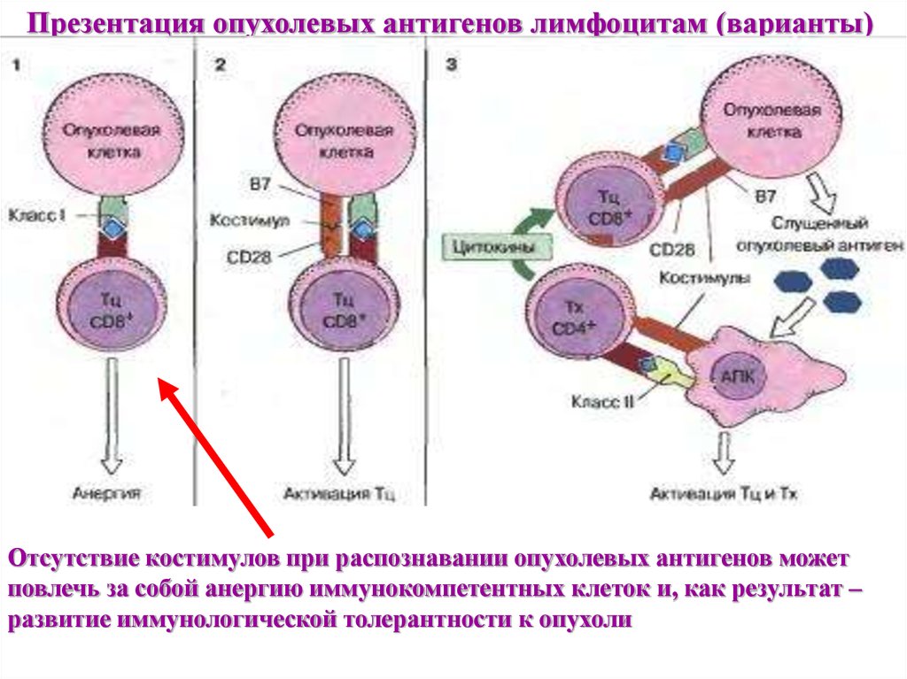 Отсутствие лимфоцитов. Схема презентации антигена лимфоцитам. Противоопухолевый иммунитет лимфоциты. Распознавание антигена т-лимфоцитами схема. Презентация антигена иммунология.