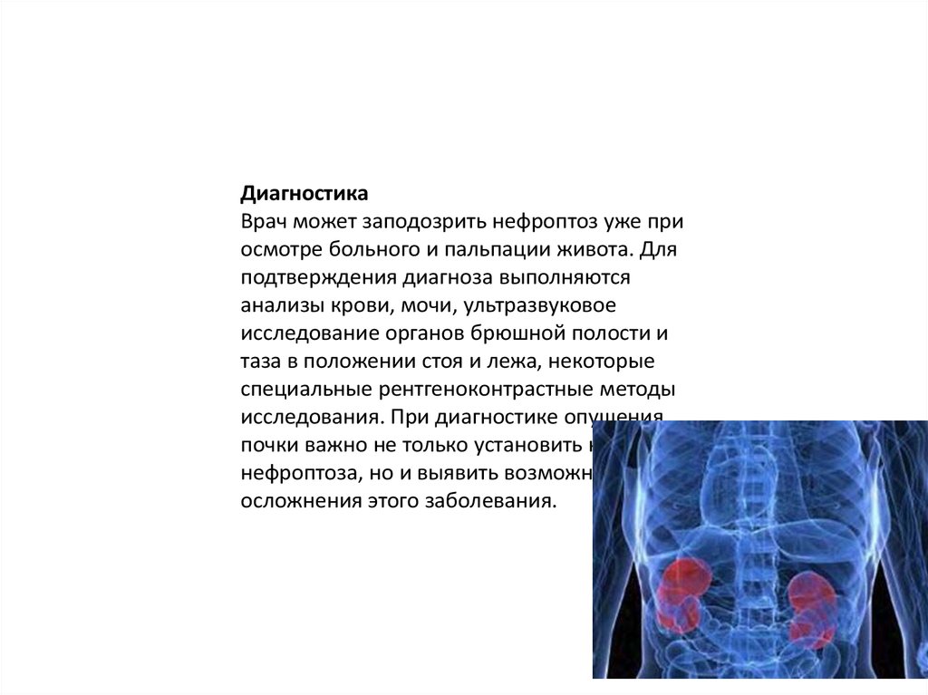 Ноющая боль в области левой почки