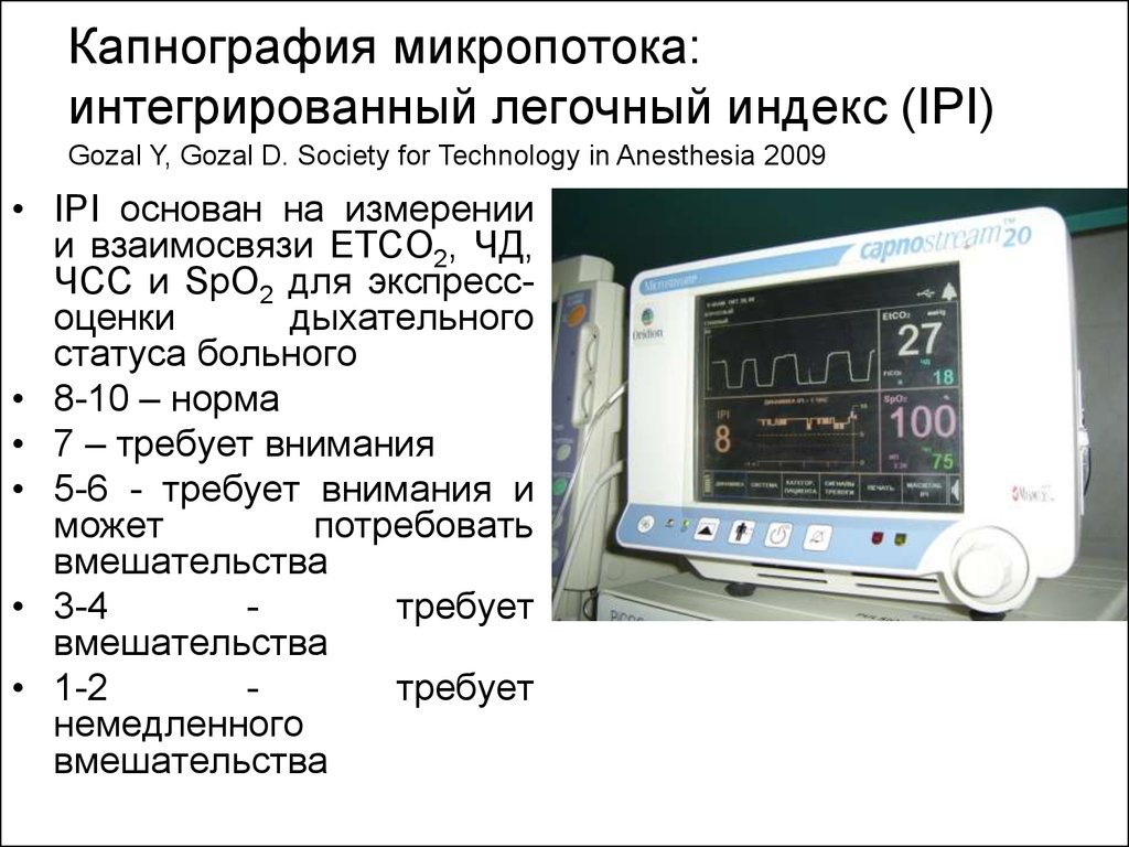 Капнография в мониторе для чего