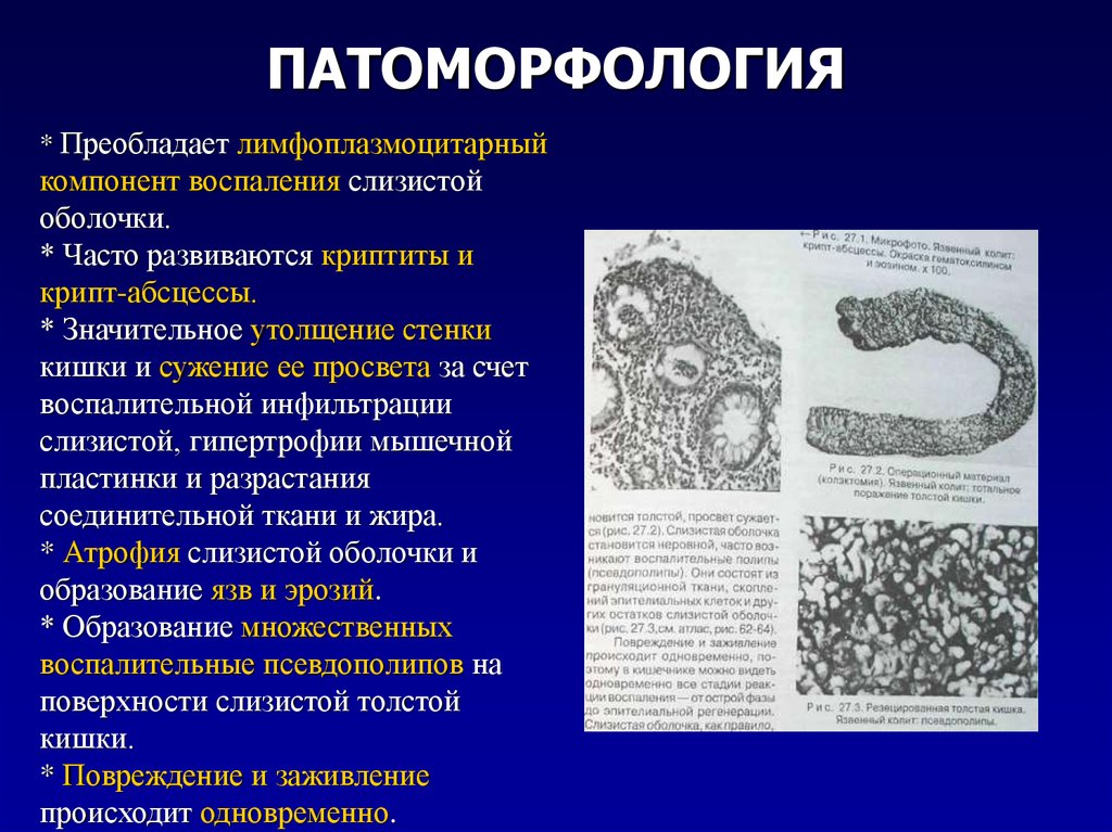 Выстилает стенки кишечника