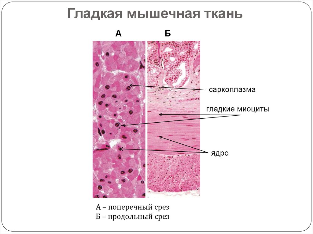 Гладкая мышечная ткань рисунок с подписями