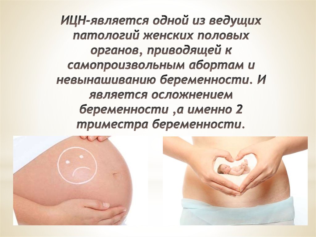 Как удлинить матку при беременности. Истмико-цервикальная недостаточность. Истмико-цервикальная недостаточность (ИЦН). Цервикальная недостаточность при беременности.