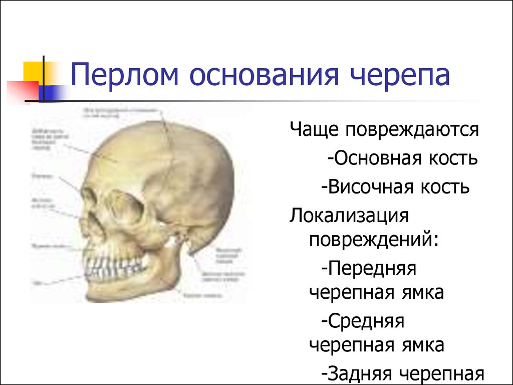 Основание черепа где. Височная кость кость черепа. Слабая кость черепа человека. Перечислите кости свода и основания черепа. Основание черепа кости его образующие.