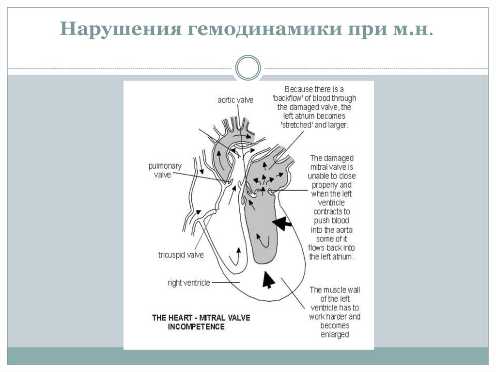 Презентация пороки сердца пропедевтика