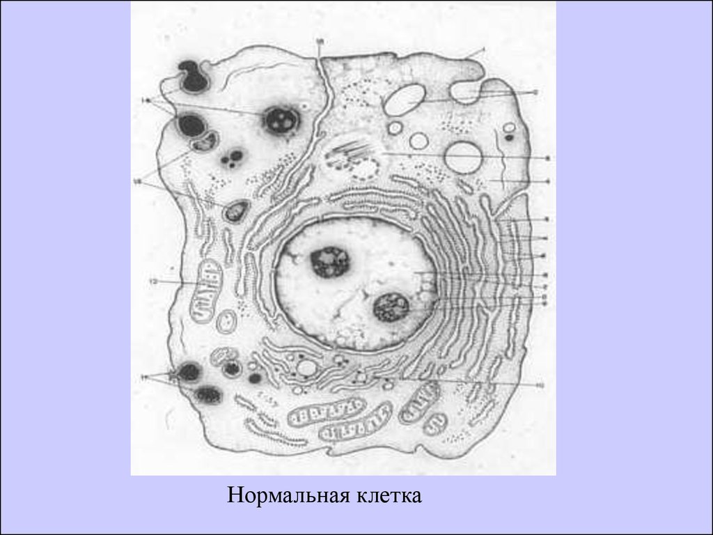 Нормальная клетка. Поврежденная клетка. Нормальная клетка человека. Поврежденная клетка человека.