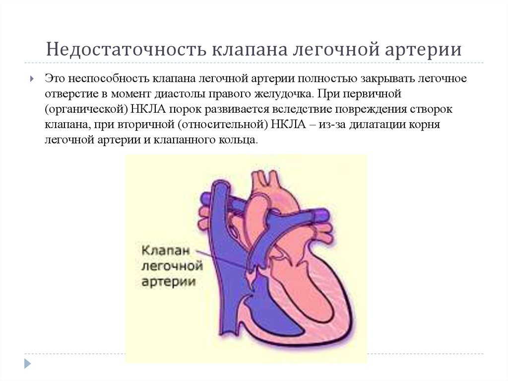 Приобретенные пороки сердца факультетская терапия презентация