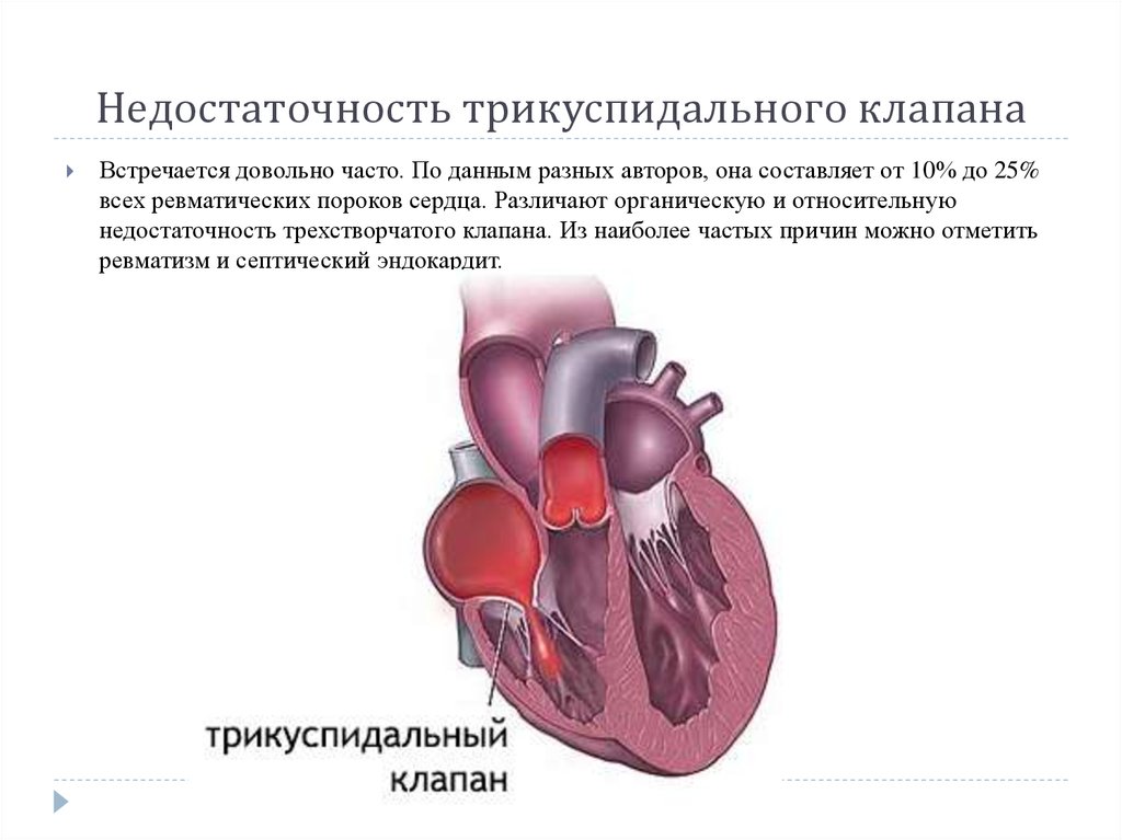 Порок сердца и сердечная недостаточность