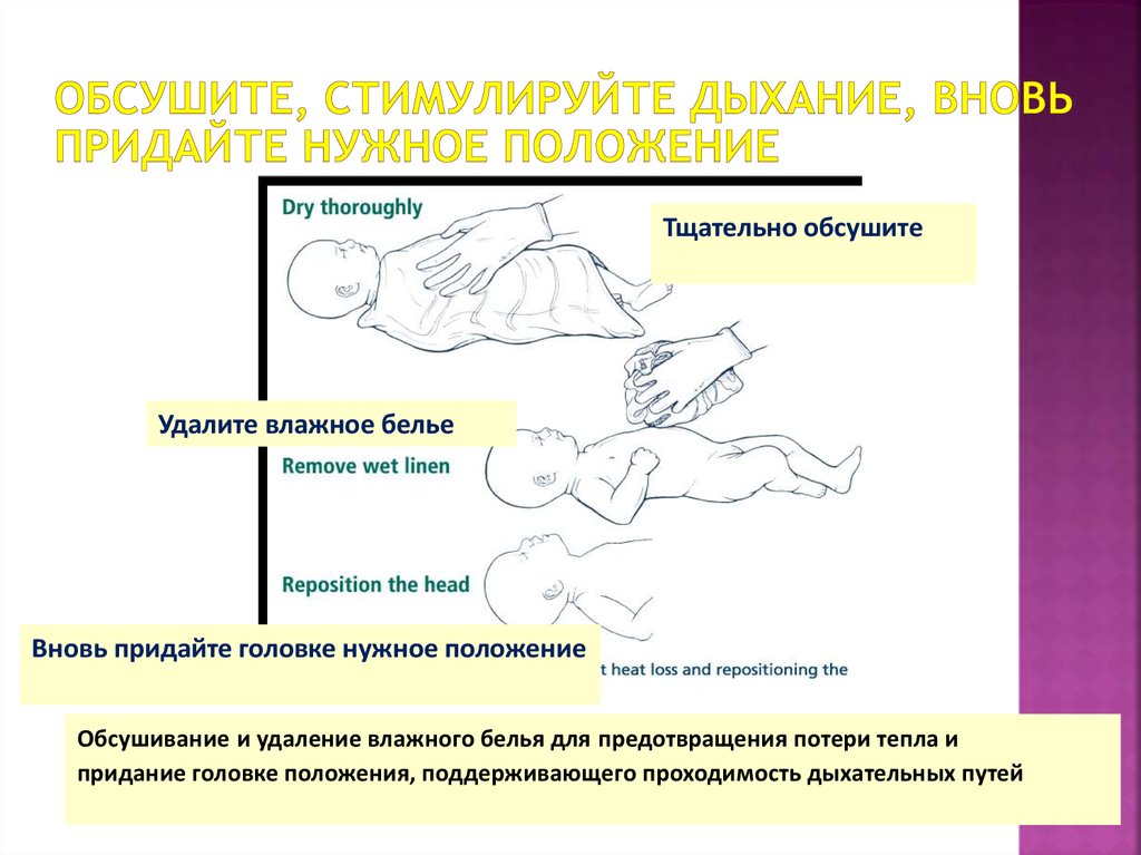 Оценка состояния новорожденного презентация