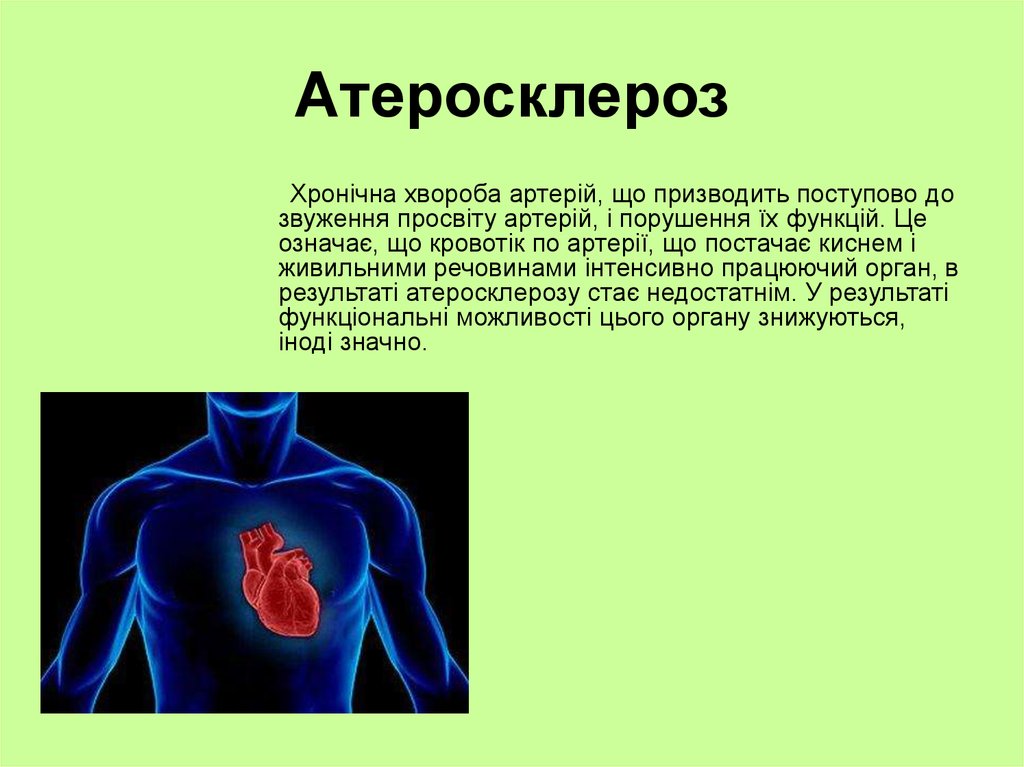 Атеросклероз