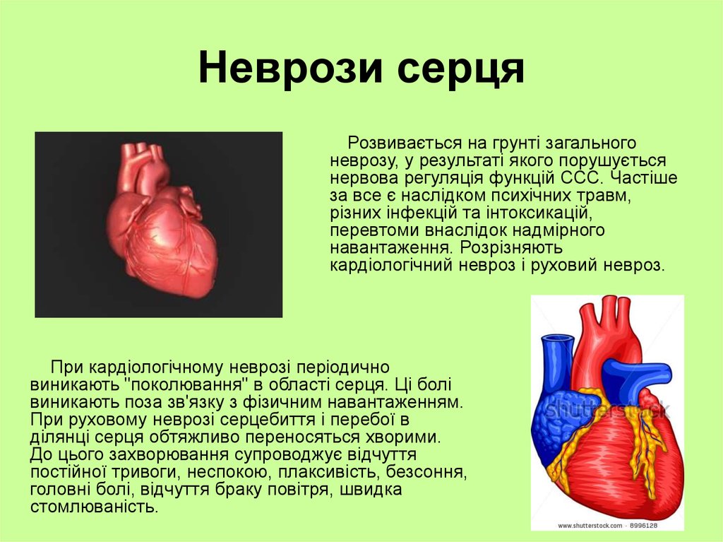 Неврози серця