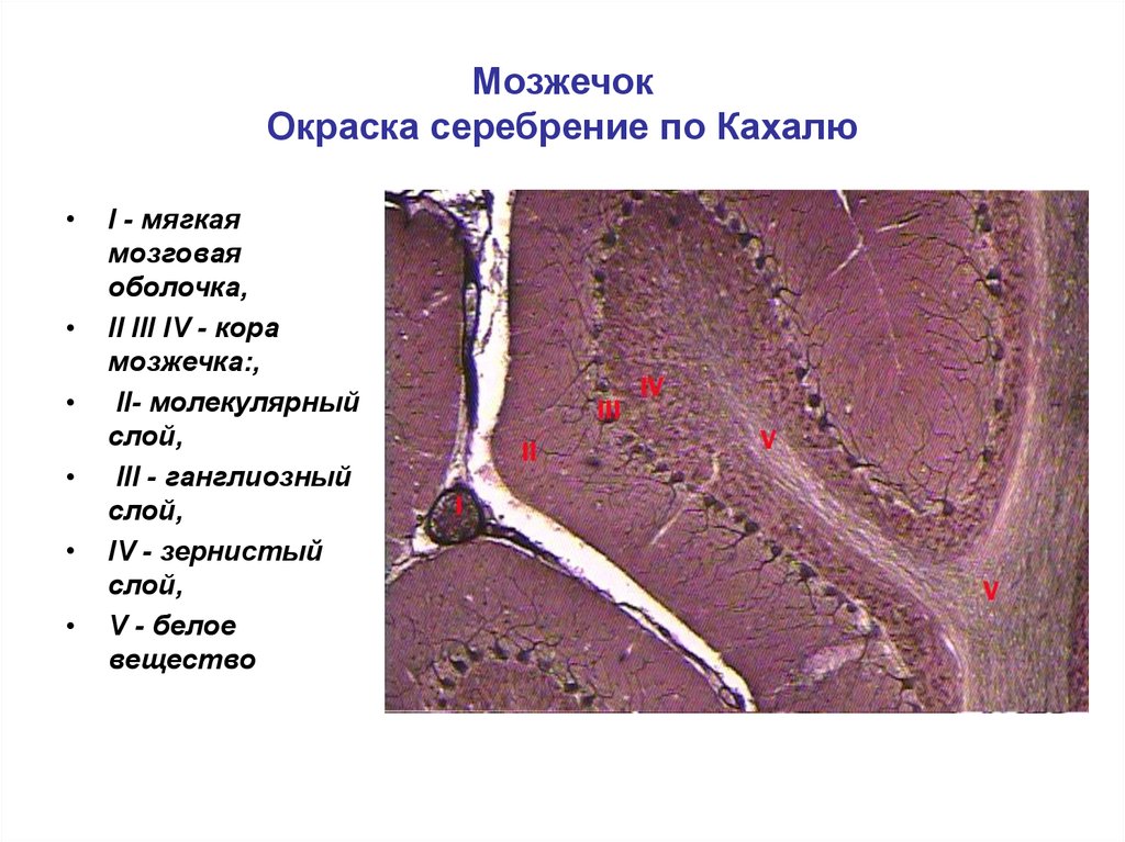 Мозжечок гистология рисунок