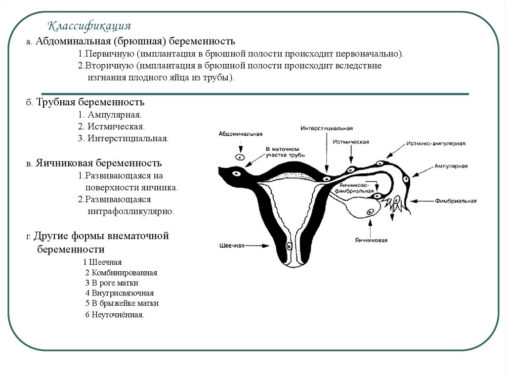 Внематочная беременность сохраняют ли. Трубная беременность классификация. Внематочная Трубная ампулярная беременность. Внематочная беременность схема. Истмическая внематочная беременность.