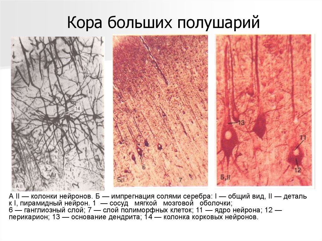 Слои клеток головного мозга. Импрегнация солями серебра нервная ткань.