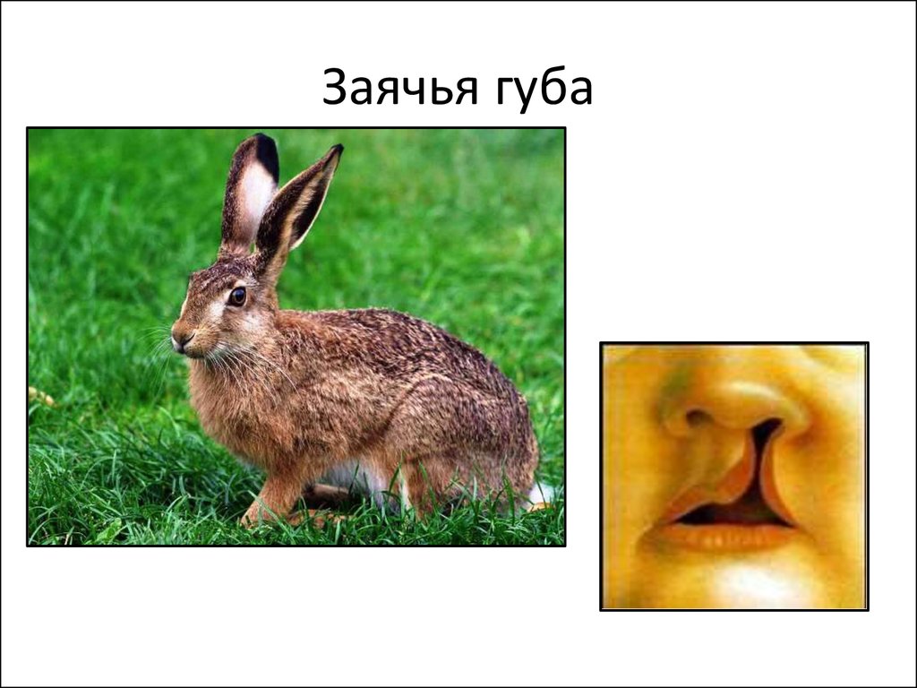 Как нарисовать заячью губу в tiny bunny