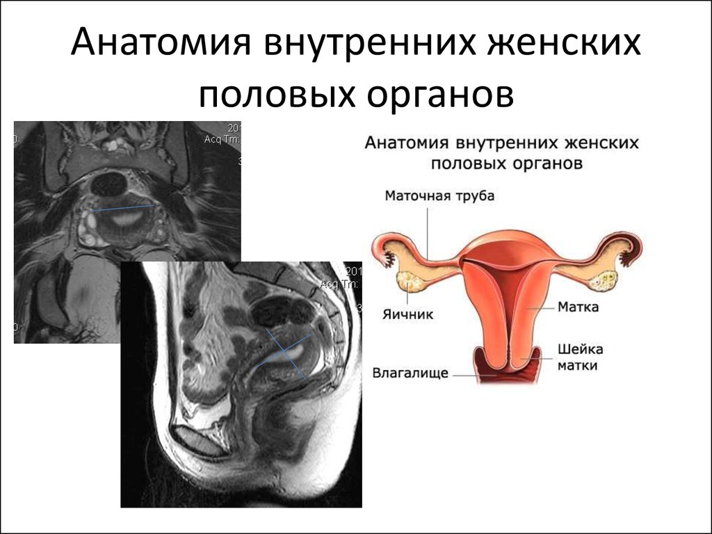 Анатомия матки презентация