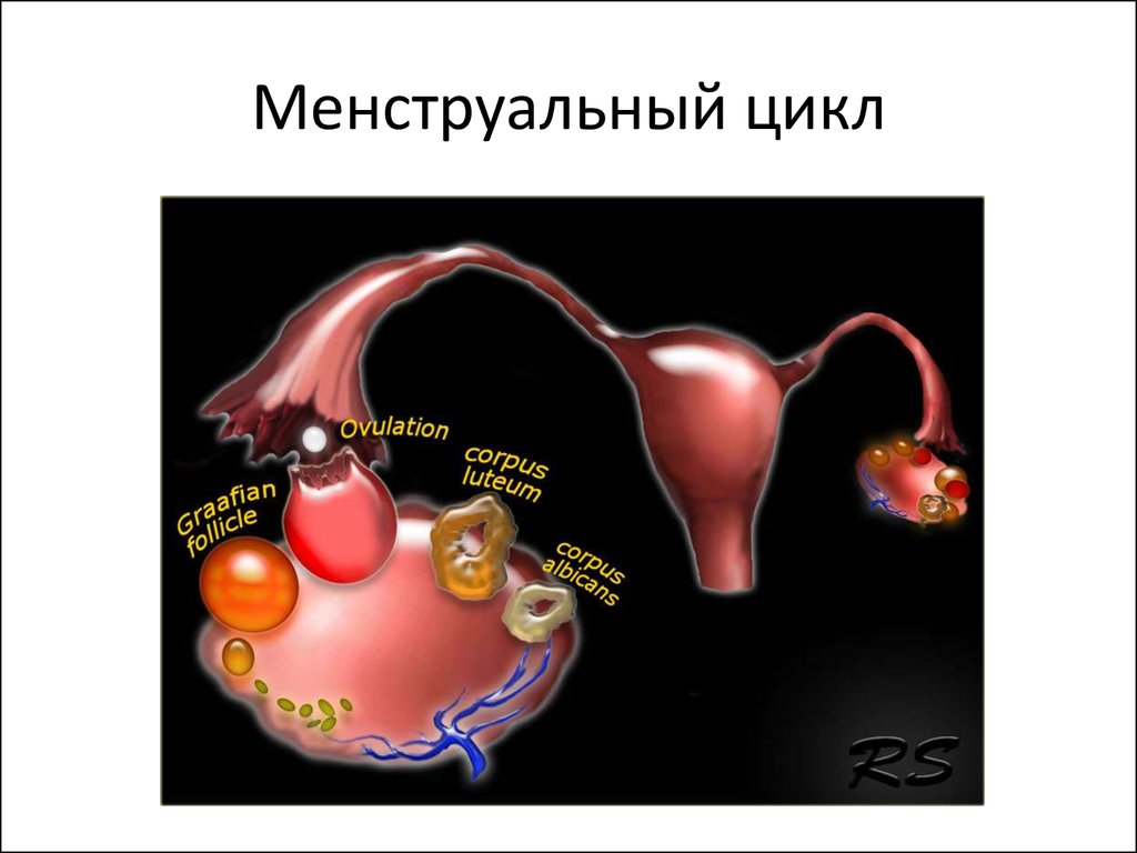 Инволютивные изменения яичников что это. Фуз-абляция миомы матки. Фуз абляция при миоме матки. Фуз абляция миомы в Москве.