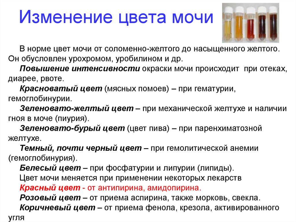 Может ди. Изменение цвета мочи. Цвет мочи норма. Изменение цвета мочи причины. Изменение окраски мочи.