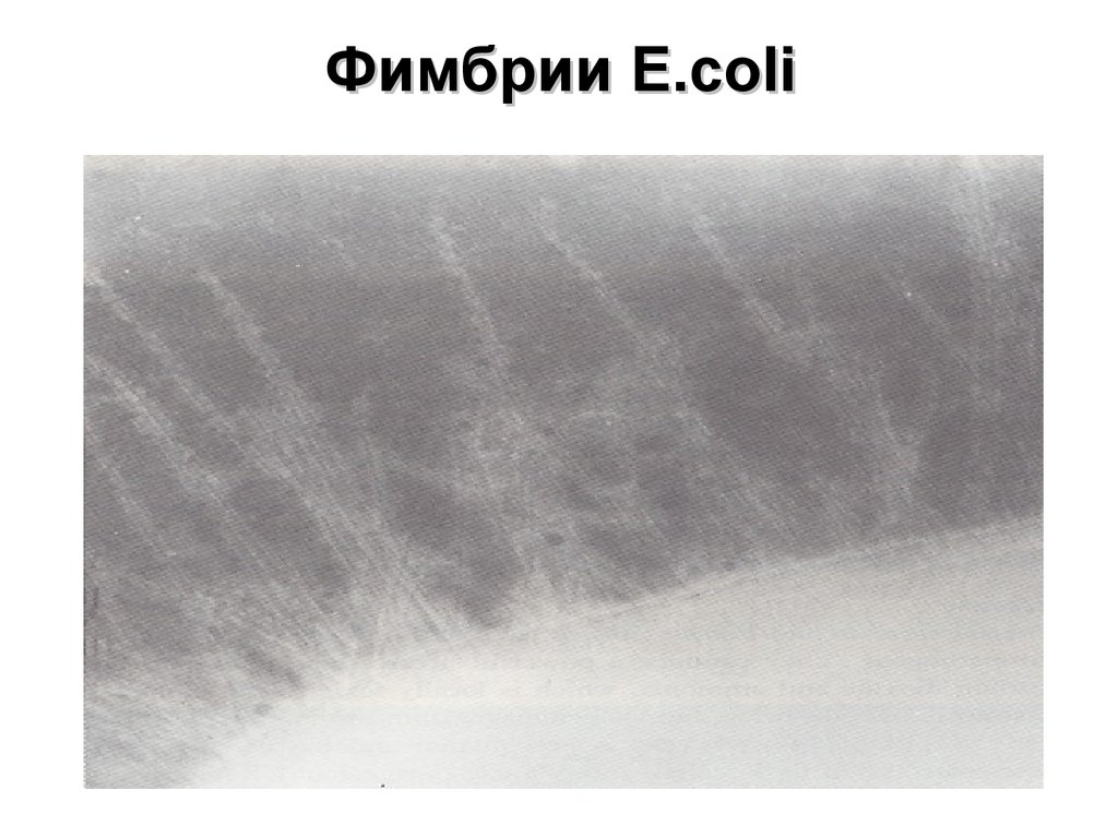 Фимбрии E.coli