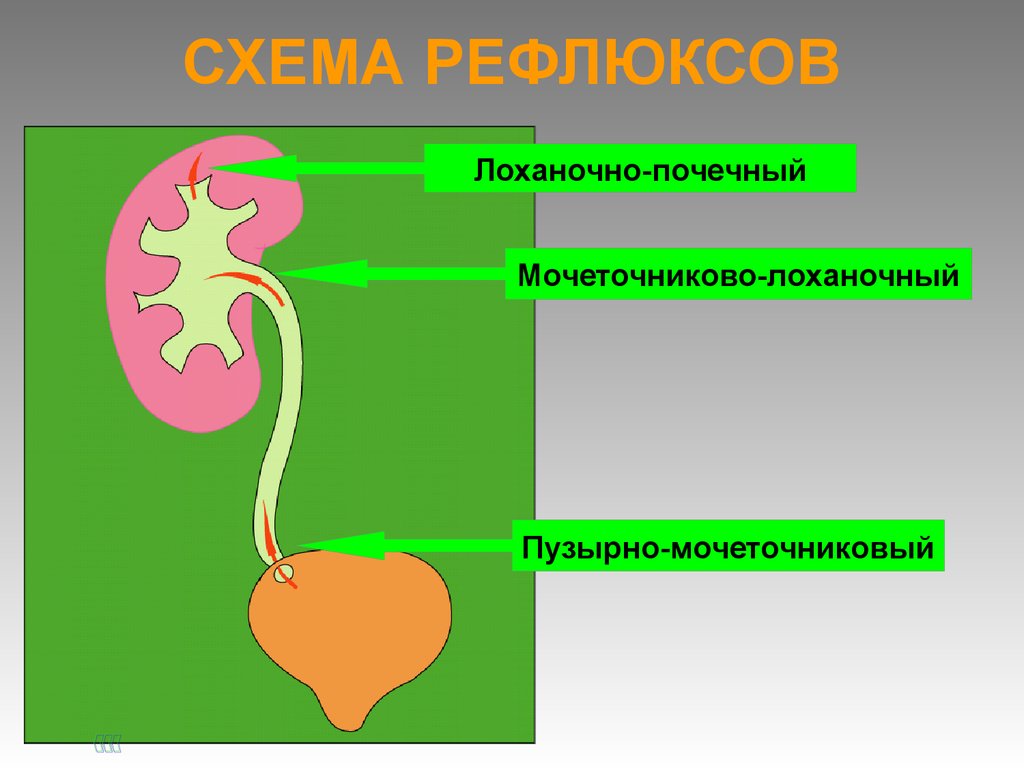 Рефлюкс нефропатия презентация