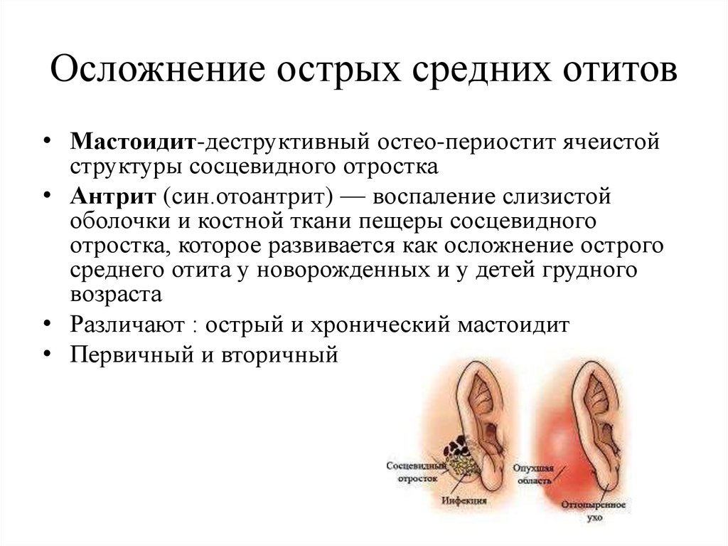 Осложнение слуха