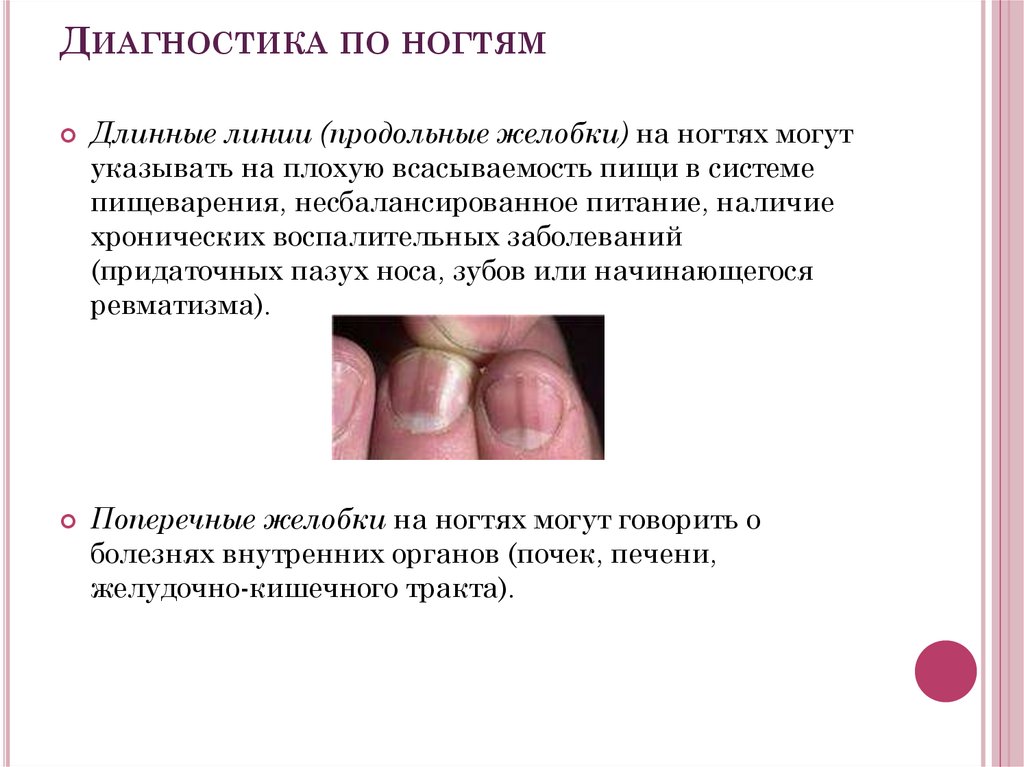 Диагностика по ногтям рук фото и описание