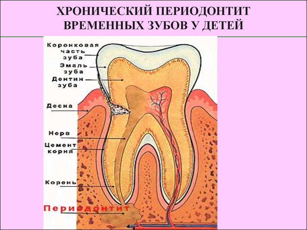 Диагностика пульпита презентация