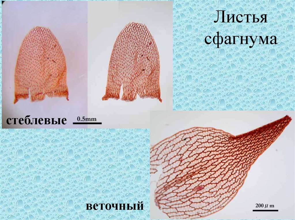 Листья сфагнума. Лист сфагнума. Стеблевой лист сфагнума. Строение веточного листа сфагнума. Стеблевые и веточные листья сфагнума.