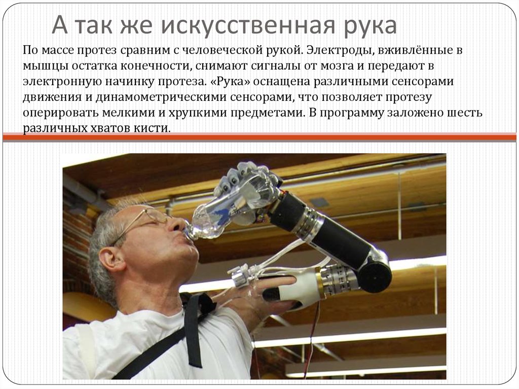 А так же искусственная рука