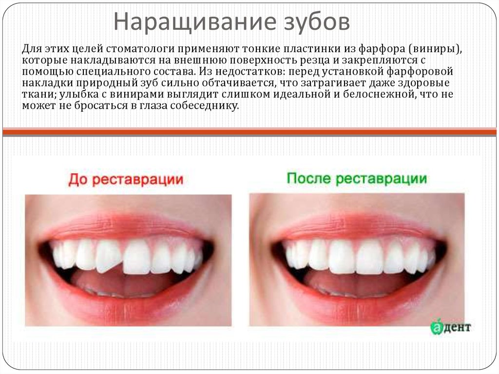 Сколько по времени делают зубы