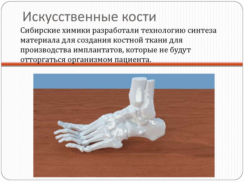 Искусственные кости