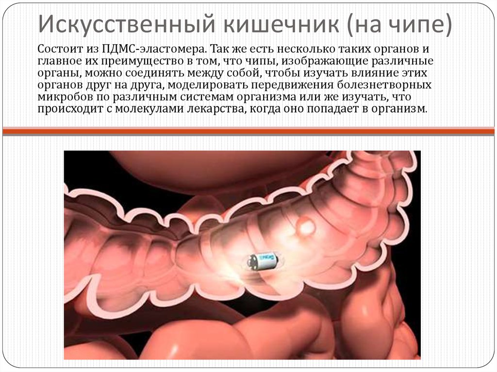 Искусственный кишечник (на чипе)