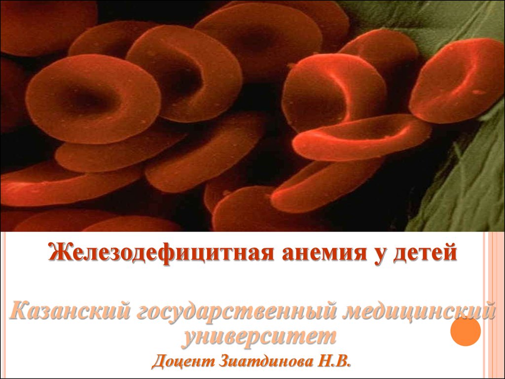 Реферат: Железодефицитная анемия у детей
